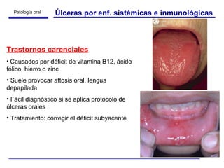 Úlceras por enf. sistémicas e inmunológicas Trastornos carenciales Causados por déficit de vitamina B12, ácido fólico, hierro o zinc Suele provocar aftosis oral, lengua depapilada Fácil diagnóstico si se aplica protocolo de úlceras orales Tratamiento: corregir el déficit subyacente 