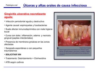 Úlceras y aftas orales de causa infecciosa Gingivitis ulcerativa necrotizante aguda: Infección periodontal aguda y destructiva Agente causal: espiroquetas y fusobacterias Suele afectar inmunodeprimidos con mala higiene bucal Cursa con dolor, inflamación, edema  y necrosis gingival (papilas interdentales) Presencia de membrana grisácea en las zonas afectadas Sangrado espontáneo o con pequeños traumatismos SOLICITAR VIH Tratamiento: Debridamiento + Clorhexidina ATB según cultivos 