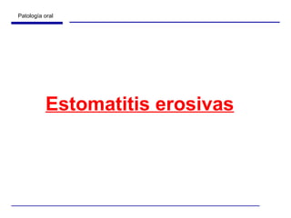 Estomatitis erosivas 