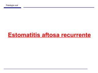 Estomatitis aftosa recurrente 