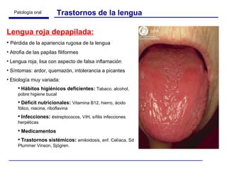 Lengua roja depapilada: Pérdida de la apariencia rugosa de la lengua Atrofia de las papilas filiformes Lengua roja, lisa con aspecto de falsa inflamación Síntomas: ardor, quemazón, intolerancia a picantes Etiología muy variada: Hábitos higiénicos deficientes:  Tabaco, alcohol, pobre higiene bucal Déficit nutricionales:   Vitamina B12, hierro, ácido fólico, niacina, riboflavina Infecciones:  e streptococos, VIH, sífilis infecciones herpéticas Medicamentos Trastornos sistémicos:   amiloidosis, enf. Celíaca, Sd Plummer Vinson, Sjögren. Trastornos de la lengua 