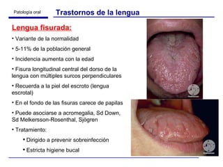 Lengua fisurada: Variante de la normalidad 5-11% de la población general Incidencia aumenta con la edad Fisura longitudinal central del dorso de la lengua con múltiples surcos perpendiculares Recuerda a la piel del escroto (lengua escrotal) En el fondo de las fisuras carece de papilas  Puede asociarse a acromegalia, Sd Down, Sd Melkersson-Rosenthal, Sjögren Tratamiento:  Dirigido a prevenir sobreinfección Estricta higiene bucal Trastornos de la lengua 