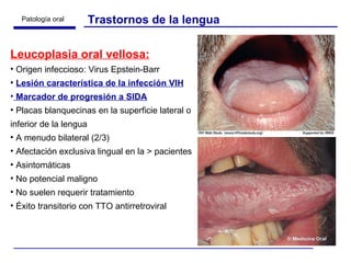 Leucoplasia oral vellosa: Origen infeccioso: Virus Epstein-Barr Lesión característica de la infección VIH Marcador de progresión a SIDA Placas blanquecinas en la superficie lateral o inferior de la lengua A menudo bilateral (2/3) Afectación exclusiva lingual en la > pacientes Asintomáticas No potencial maligno No suelen requerir tratamiento Éxito transitorio con TTO antirretroviral Trastornos de la lengua 