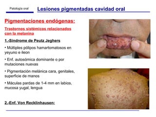 Lesiones pigmentadas cavidad oral Pigmentaciones endógenas: Trastornos sistémicos relacionados con la melanina 1.-Sindrome de Peutz Jeghers Múltiples pólipos hamartomatosos en yeyuno e ileon Enf. autosómica dominante o por mutaciones nuevas Pigmentación melánica cara, genitales, superficie de manos Máculas pardas de 1-4 mm en labios, mucosa yugal, lengua 2.-Enf. Von Recklinhausen: 
