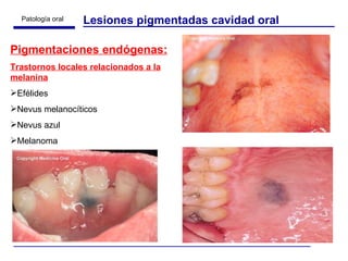 Lesiones pigmentadas cavidad oral Pigmentaciones endógenas: Trastornos locales relacionados a la melanina Efélides Nevus melanocíticos Nevus azul Melanoma 