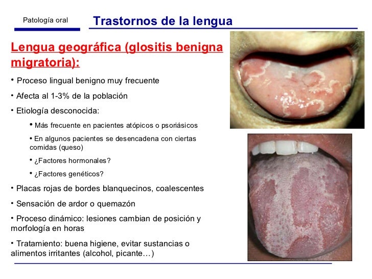Lesiones De Cavidad Oral