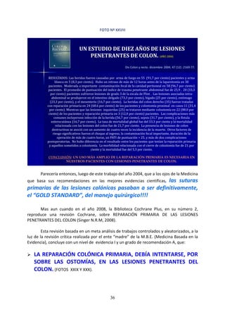 36
FOTO Nº XXVIII
UN ESTUDIO DE DIEZ AÑOS DE LESIONES
PENETRANTES DE COLON. (AÑO 2004)
Dis Colon y recto. diciembre 2004; 47 (12) :2169-77.
RESULTADOS: Las heridas fueron causadas por arma de fuego en 55 (91,7 por ciento) pacientes y arma
blanca en 5 (8,3 por ciento). Hubo un retraso de más de 12 horas antes de la laparotomía en 30
pacientes. Moderada a importante contaminación fecal de la cavidad peritoneal en 58 (96,7 por ciento)
pacientes. El promedio de puntuación del indice de trauma penetrante abdominal fue de 25,9 . 20 (33,3
por ciento) pacientes sufrieron lesiones de grado 3 de la escala de Flint . Las lesiones asociadas intra-
abdominal se produjeron en el intestino delgado (73,3 por ciento), hígado (25 por ciento), estómago
(23,3 por ciento), y el mesenterio (16,7 por ciento). La heridas del colon derecho (35) fueron tratadas
con reparación primaria en 24 (68.6 por ciento) de los pacientes y colostomía proximal en casos 11 (31,4
por ciento). Mientras que las lesiones izquierdas (25) se trataron mediante colostomía en 22 (88.0 por
ciento) de los pacientes y reparación primaria en 3 (12,0 por ciento) pacientes. Las complicaciones más
comunes incluyeronn infección de la herida (56,7 por ciento), sepsis (31,7 por ciento), y la fístula
enterocutánea (16,7 por ciento). La tasa de mortalidad global fue del 33,3 por ciento y la mortalidad
relacionada con las lesiones del colon fue de 21,7 por ciento. La presencia de lesiones de colon
destructivas se asoció con un aumento de cuatro veces la incidencia de la muerte. Otros factores de
riesgo significativos fueron el choque al ingreso, la contaminación fecal importante, duración de la
operación de más de cuatro horas, un PATI de puntuación > 25, y más de dos complicaciones
postoperatorias. No hubo diferencia en el resultado entre los pacientes que tenían la reparación primaria
y aquellos sometidos a colostomía. La morbilidad relacionada con el cierre de colostomía fue de 21 por
ciento y la mortalidad fue del 5,3 por ciento.
CONCLUSIÓN: UN USO MÁS AMPLIO DE LA REPARACIÓN PRIMARIA ES NECESARIA EN
NUESTROS PACIENTES CON LESIONES PENETRANTES DE COLON.
Parecería entonces, luego de este trabajo del año 2004, que a los ojos de la Medicina
que basa sus recomendaciones en las mejores evidencias científicas, las suturas
primarias de las lesiones colónicas pasaban a ser definitivamente,
el “GOLD STANDARD”, del manejo quirúrgico!!!!
Mas aun cuando en el año 2008, la Biblioteca Cochrane Plus, en su número 2,
reproduce una revisión Cochrane, sobre REPARACIÓN PRIMARIA DE LAS LESIONES
PENETRANTES DEL COLON (Singer N.R.M, 2008).
Esta revisión basada en un meta análisis de trabajos controlados y aleatorizados, a la
luz de la revisión crítica realizada por el ente “madre” de la M.B.E. (Medicina Basada en la
Evidencia), concluye con un nivel de evidencia I y un grado de recomendación A, que:
LA REPARACIÓN COLÓNICA PRIMARIA, DEBÍA INTENTARSE, POR
SOBRE LAS OSTOMÍAS, EN LAS LESIONES PENETRANTES DEL
COLON. (FOTOS XXIX Y XXX).
 