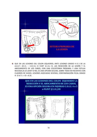70
SUTURA PRIMARIA DE
LA LESIÓN
QUE EN LAS LESIONES DEL COLON IZQUIERDO, ANTE LESIONES GRADO 4 O 5 DE LA
A.A.S.T. (O.I.S. – C.O.I.S.) O FLINT (C.I.S.) III, LAS RESECCIÓN DE LA LESIÓN Y EL
ABOCAMIENTO DE LOS CABOS, CON UNA COLOSTOMIA PROXIMAL Y UNA FISTULA
MUCOSA (A LO LAHEY O NO, ES UNA OPCIÓN SEGURA, SOBRE TODO EN PACIENTES CON
CUADROS DE SHOCK, LESIONES ASOCIADAS SEVERAS, CONTAMINACIÓN FECAL GRADO
III O A.T.I. > O = A 25.
QUE EN LAS LESIONES DEL COLON IZQUIERDO LA
RESECCIÓN Y EL ABOCAMIENTO DE LOS CABOS,
ES UNA OPCIÓN SEGURA EN INJURIAS C.O.I.S. 4 o 5
o FLINT (C.I.S.) III
 