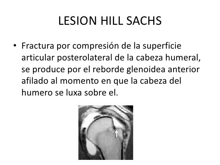 Lesiones de hombro