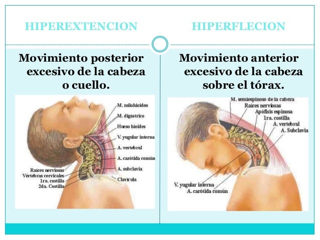 El tratamiento de la columna vertebral shmorlya