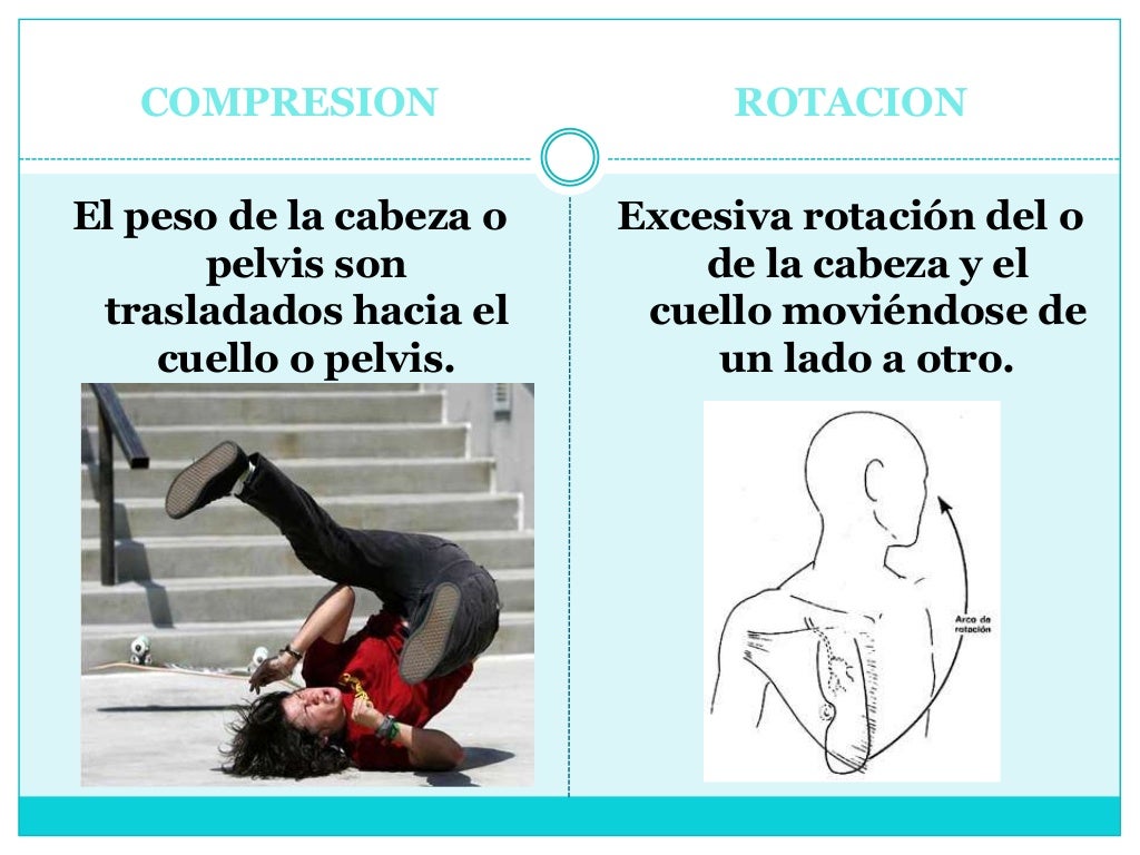 COMPRESION

ROTACION

El peso de la cabeza o
pelvis son
trasladados hacia el
cuello o pelvis.

Excesiva rotación del o
de ...