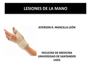 LESIONES DE LA MANO



      JEFERSON R. MANCILLA LEÓN




        FACULTAD DE MEDICINA
      UNIVERSIDAD DE SANTANDER
                UDES
 