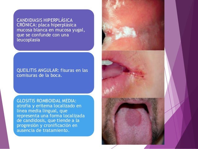 Lesiones de la mucosa oral