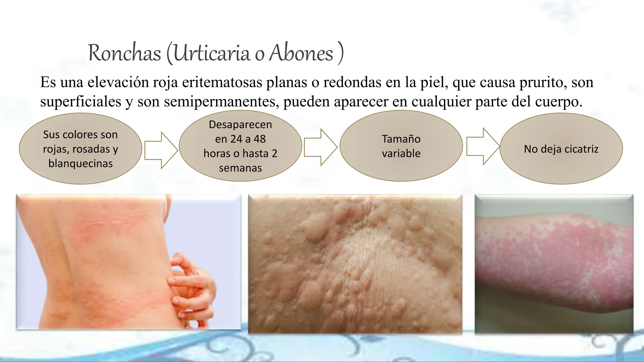 lesiones de la piel ronchas y vesiculas.pptx