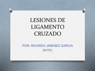 LESIONES DE
LIGAMENTO
CRUZADO
POR: RICARDO JIMENEZ GARCIA
DHTIC
 