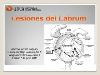 Lesiones del Labrum Alumno: Álvaro Lagos N N.docente: Klgo Joaquín Adi A. Asignatura: Kinesioterapia I. Fecha: 7 de junio 2011 