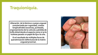 Traquioniquia.
Alteración de la lámina o cuerpo ungueal
caracterizada por rugosidad, crestas
longitudinales excesivas, punteado,
engrosamiento de la cutícula y pérdida de
brillo distal dando el aspecto como si se le
hubiese pasado un papel de lija a la uña.
Es el resultado de múltiples focos de
queratinización defectuosa de la matriz
ungueal proximal.
 