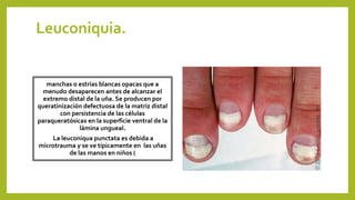 Leuconiquia.
manchas o estrías blancas opacas que a
menudo desaparecen antes de alcanzar el
extremo distal de la uña. Se producen por
queratinización defectuosa de la matriz distal
con persistencia de las células
paraqueratósicas en la superficie ventral de la
lámina ungueal.
La leuconiqua punctata es debida a
microtrauma y se ve típicamente en las uñas
de las manos en niños (
 
