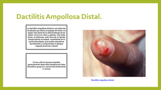 Dactilitis Ampollosa Distal.
La dactilitis ampollosa distal es una infección
localizada que afecta el pulpejo del dedo o la
región más distal de la última falange de los
dedos. Ocurre en niños y adultos. Una bulla
tensa, no dolorosa, oval, llena de un líquido
seropurulento no espeso usualmente en la
punta del pulpejo, que puede extenderse
dorsalmente y comprometer el pliegue
ungueal proximal y lateral
En los cultivos de esas ampollas
generalmente desarrolla estreptococo beta
hemolítico grupo A y menos frecuentemente
S. aureus
Dactilitis ampollosa distal.
 