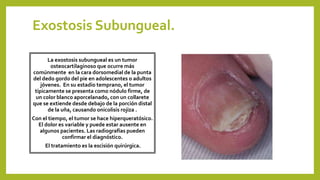 Exostosis Subungueal.
La exostosis subungueal es un tumor
osteocartilaginoso que ocurre más
comúnmente en la cara dorsomedial de la punta
del dedo gordo del pie en adolescentes o adultos
jóvenes. En su estadio temprano, el tumor
típicamente se presenta como nódulo firme, de
un color blanco aporcelanado, con un collarete
que se extiende desde debajo de la porción distal
de la uña, causando onicolisis rojiza .
Con el tiempo, el tumor se hace hiperqueratósico.
El dolor es variable y puede estar ausente en
algunos pacientes. Las radiografías pueden
confirmar el diagnóstico.
El tratamiento es la escisión quirúrgica.
 