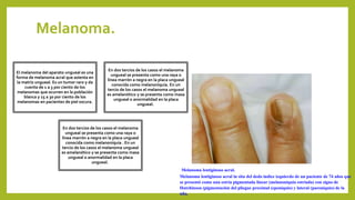 Melanoma.
El melanoma del aparato ungueal es una
forma de melanoma acral que asienta en
la matriz ungueal. Es un tumor raro y da
cuenta de 1 a 3 por ciento de los
melanomas que ocurren en la población
blanca y 15 a 30 por ciento de los
melanomas en pacientes de piel oscura.
En dos tercios de los casos el melanoma
ungueal se presenta como una raya o
línea marrón a negra en la placa ungueal
conocida como melanoniquia. En un
tercio de los casos el melanoma ungueal
es amelanótico y se presenta como masa
ungueal o anormalidad en la placa
ungueal.
En dos tercios de los casos el melanoma
ungueal se presenta como una raya o
línea marrón a negra en la placa ungueal
conocida como melanoniquia . En un
tercio de los casos el melanoma ungueal
es amelanótico y se presenta como masa
ungueal o anormalidad en la placa
ungueal.
Melanoma lentiginoso acral.
Melanoma lentiginoso acral in situ del dedo índice izquierdo de un paciente de 74 años que
se presentó como una estría pigmentada linear (melanoniquia estriada) con signo de
Hutchinson (pigmentación del pliegue proximal (eponiquio) y lateral (paroniquio) de la
uña.
 
