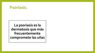 Psoriasis.
La psoriasis es la
dermatosis que más
frecuentemente
compromete las uñas
 