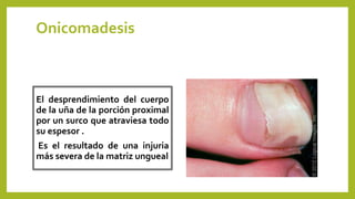 Onicomadesis
El desprendimiento del cuerpo
de la uña de la porción proximal
por un surco que atraviesa todo
su espesor .
Es el resultado de una injuria
más severa de la matriz ungueal
 