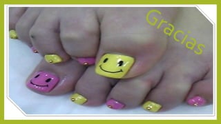 Lesiones del lecho ungueal