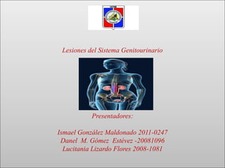 Lesiones del Sistema Genitourinario
Presentadores:
Ismael González Maldonado 2011-0247
Danel M. Gómez Estévez -20081096
Lucitania Lizardo Flores 2008-1081
 