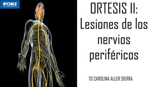 ORTESIS II:
Lesiones de los
nervios
periféricos
TO CAROLINA ALLER SIERRA
 
