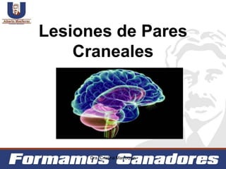Lesiones de Pares
Craneales
Dra. Cristina Marroquin
 