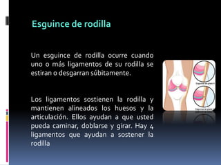 Un esguince de rodilla ocurre cuando
uno o más ligamentos de su rodilla se
estiran o desgarran súbitamente.
Los ligamentos sostienen la rodilla y
mantienen alineados los huesos y la
articulación. Ellos ayudan a que usted
pueda caminar, doblarse y girar. Hay 4
ligamentos que ayudan a sostener la
rodilla
Esguince de rodilla
 