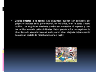  Golpes directos a la rodilla: Los esguinces pueden ser causados por
golpes o choques en la parte frontal, en los lados, o en la parte trasera
rodillas. Los esguinces también pueden ser causados al tropezar y caer
las rodillas cuando están dobladas. Usted puede sufrir un esguince de
al ser lanzado violentamente al suelo, como al ser atajado violentamente
durante un partido de fútbol americano o rugby.
 