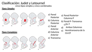 Judet Letournel Classification LESIONES DE PELVIS Y FX E ACETABULO.pptx