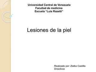 Lesiones de la piel
Realizado por: Zlatko Castillo
Drozdicoc
Universidad Central de Venezuela
Facultad de medicina
Escuela “Luis Razetti”
 