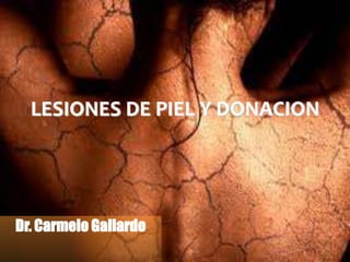 LESIONES DE PIEL Y DONACION
Dr. Carmelo Gallardo
 