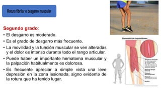 Segundo grado:
• El desgarro es moderado.
• Es el grado de desgarro más frecuente.
• La movilidad y la función muscular se ven alteradas
y el dolor es intenso durante todo el rango articular.
• Puede haber un importante hematoma muscular y
la palpación habitualmente es dolorosa.
• Es frecuente apreciar a simple vista una leve
depresión en la zona lesionada, signo evidente de
la rotura que ha tenido lugar.
 