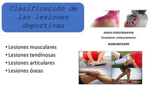 • Lesiones musculares
• Lesiones tendinosas
• Lesiones articulares
• Lesiones óseas
Clasificación de
las lesiones
deportivas
 