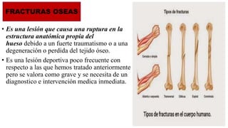 • Es una lesión que causa una ruptura en la
estructura anatómica propia del
hueso debido a un fuerte traumatismo o a una
degeneración o perdida del tejido óseo.
• Es una lesión deportiva poco frecuente con
respecto a las que hemos tratado anteriormente
pero se valora como grave y se necesita de un
diagnostico e intervención medica inmediata.
FRACTURAS OSEAS
 