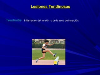 Lesiones TendinosasLesiones Tendinosas
TendinitisTendinitis :: Inflamación del tendón o de la zona de inserción.
 