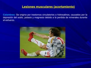 Calambres: Se origina por trastornos circulatorios o hidrosalinos, causados por la
depresión del sodio, potasio y magnesio debido a la perdida de minerales durante
el esfuerzo.
Lesiones musculares (acortamiento)
 