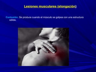 Contusión: Se produce cuando el músculo se golpea con una estructura
sólida.
Lesiones musculares (elongación)
 