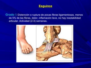 EsguinceEsguince
GradoGrado II:: Distención o ruptura de pocas fibras ligamentosas, menos
de 5% de las fibras, dolor, inflamación leve, no hay inestabilidad
articular. Actividad (2-3) semanas.
 