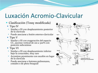 Tossy Radiopaedia Lesiones deportivas en urgencia | PPT