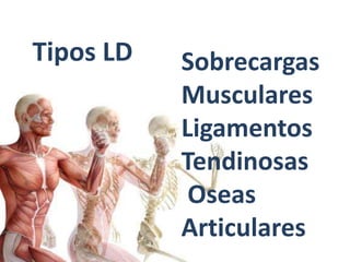 Tipos LD Sobrecargas 
Musculares 
Ligamentos 
Tendinosas 
Oseas 
Articulares 
 