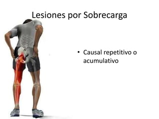 Lesiones por Sobrecarga 
• Causal repetitivo o 
acumulativo 
 