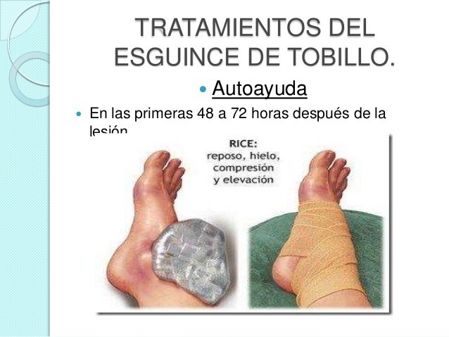 Como comienza el hongo sobre el pulgar del pie