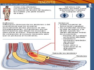 TENDINITIS   