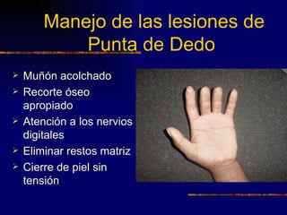 Manejo de las lesiones de
            Punta de Dedo
   Muñón acolchado
   Recorte óseo
    apropiado
   Atención a los nervios
    digitales
   Eliminar restos matriz
   Cierre de piel sin
    tensión
 