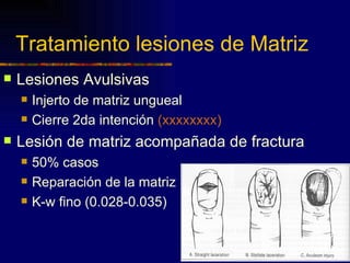 Tratamiento lesiones de Matriz
   Lesiones Avulsivas
       Injerto de matriz ungueal
       Cierre 2da intención (xxxxxxxx)
   Lesión de matriz acompañada de fractura
       50% casos
       Reparación de la matriz
       K-w fino (0.028-0.035)
 